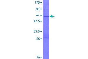 Image no. 1 for Progesterone Receptor Membrane Component 2 (PGRMC2) (AA 1-223) protein (GST tag) (ABIN1314843)