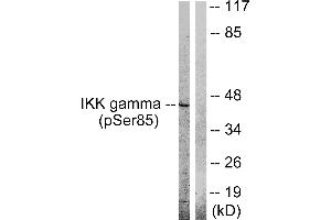 Western blot analysis of extracts from HepG2 cells, treated with Anisomycin (0. (IKBKG anticorps  (pSer85))