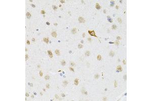 Immunohistochemistry of paraffin-embedded mouse brain using SYK Antibody (ABIN5971150) at dilution of 1/100 (40x lens). (SYK anticorps)