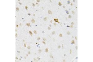 Immunohistochemistry of paraffin-embedded mouse brain using SYK Antibody (ABIN5971150) at dilution of 1/100 (40x lens). (SYK anticorps)