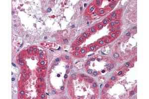 Immunohistochemistry (IHC) image for anti-Albumin (ALB) (Middle Region) antibody (ABIN2776970) (Albumin anticorps  (Middle Region))