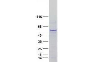 Validation with Western Blot