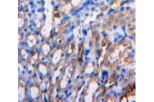 IHC-P analysis of Kidney tissue, with DAB staining. (IL-15 anticorps  (AA 49-162))