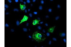 Immunofluorescence (IF) image for anti-F-Box Protein 21 (FBXO21) antibody (ABIN1498234)