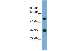 Host:  Rabbit  Target Name:  NPAS3  Sample Type:  THP-1 Whole Cell lysates  Antibody Dilution:  1. (NPAS3 anticorps  (Middle Region))