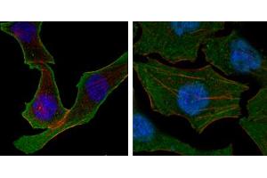 Confocal immunofluorescence analysis of SKBR-3 (left) and A549 (right) cells using Calreticulin mouse mAb (green).