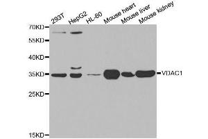 Western blot analysis of extracts of various cell lines, using VDAC1 antibody.