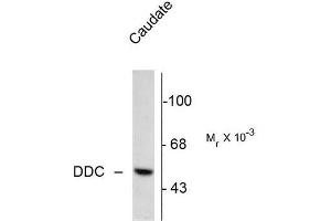 Image no. 1 for anti-Dopa Decarboxylase (Aromatic L-Amino Acid Decarboxylase) (DDC) (N-Term) antibody (ABIN372610) (DDC anticorps  (N-Term))