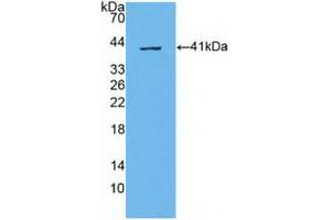 Western blot analysis of recombinant Human ABCA4. (ABCA4 anticorps  (AA 1398-1727))