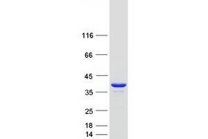 Validation with Western Blot