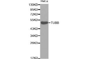 Western blot analysis of extracts of HeLa cells, using TUBB antibody (ABIN5974698). (TUBB1 anticorps)