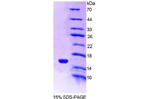 SDS-PAGE analysis of Mouse MIA1 Protein. (MIA Protéine)