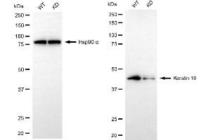 Western blotting analysis using keratin 18 antibody (ABIN7799174).