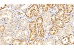 anti-Lysozyme (LYZ) (AA 24-144) antibody