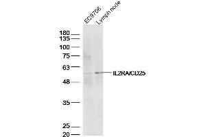 Lane 1: EC9706 lysates Lane 2: mouse lymph node lysates probed with IL2RA Polyclonal Antibody, Unconjugated  at 1:500 dilution and 4˚C overnight incubation. (CD25 anticorps  (AA 201-268))