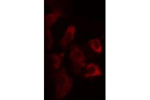 ABIN6275752 staining Hela cells by IF/ICC.