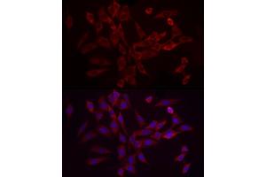 Immunofluorescence analysis of NIH/3T3 using EIF4B antibody (ABIN6127837, ABIN6140078, ABIN6140080 and ABIN6217245) at dilution of 1:25 (40x lens). (EIF4B anticorps  (AA 352-611))