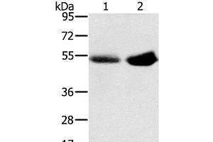 Western Blot analysis of Human placenta and plasma tissue using SLC13A3 Polyclonal Antibody at dilution of 1:200 (SLC13A3 anticorps)