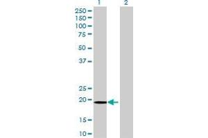Lane 1: FUNDC2 transfected lysate ( 20.