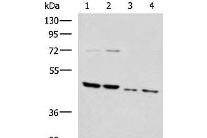 Western blot analysis of Rat brain tissue Mouse brain tissue Raji and 231 cell lysates using HTRA2 Polyclonal Antibody at dilution of 1:1000 (HTRA2 anticorps)