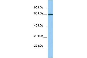 Host: Rabbit Target Name: YTHDF2 Sample Type: Jurkat Whole Cell lysates Antibody Dilution: 1. (YTHDF2 anticorps  (C-Term))