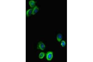 Immunofluorescent analysis of HepG2 cells using ABIN7169675 at dilution of 1:100 and Alexa Fluor 488-congugated AffiniPure Goat Anti-Rabbit IgG(H+L)