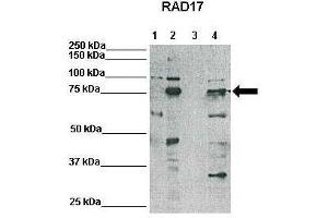WB Suggested Anti-RAD17 Antibody    Positive Control:  Lane1: 25ug HeLa lysate, Lane2: 25ug Xenopus laevis egg extract, Lane3: 25ug mouse embryonic stem cell lysate, Lane4: 25ug HEK293T lysate   Primary Antibody Dilution :   1:500  Secondary Antibody :   Anti-rabbit-HRP   Secondry Antibody Dilution :   1:3000  Submitted by:  Domenico Maiorano, Institute of Human Genetics, CNRS (RAD17 anticorps  (N-Term))