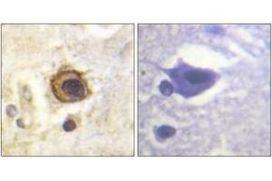 Immunohistochemistry analysis of paraffin-embedded human brain tissue, using PDGFR beta (Ab-1021) Antibody.