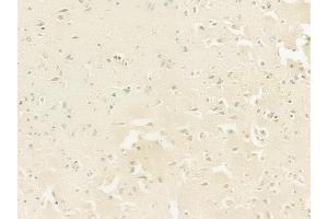 anti-Inhibitor of Growth Family, Member 3 (ING3) (Internal Region) antibody