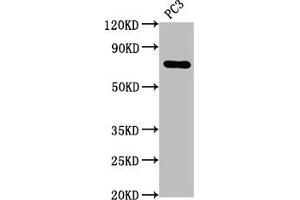 Western Blot Positive WB detected in: PC3 whole cell lysate All lanes: TP63 antibody at 2. (Recombinant p63 anticorps)
