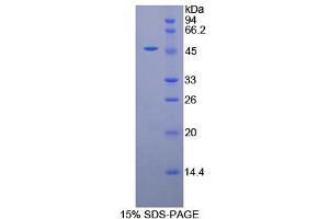 SDS-PAGE analysis of Human alpha Galactosidase Protein. (GLA Protéine)
