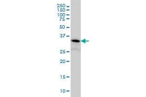 FLJ20643 monoclonal antibody (M06), clone 1E8 Western Blot analysis of FLJ20643 expression in A-431 .
