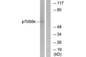 Western blot analysis of extracts from HeLa cells, treated with Insulin 10mU/ml 5', using p70 S6 Kinase (Ab-411) Antibody. (RPS6KB1 anticorps  (AA 401-450))