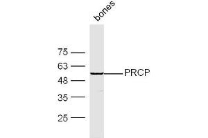 Mouse Bone lysates probed with PRCP Polyclonal Antibody, Unconjugated  at 1:300 dilution and 4˚C overnight incubation. (PRCP anticorps  (AA 101-200))