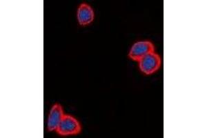 Immunofluorescent analysis of EGFR staining in MCF cells. (EGFR anticorps  (C-Term))