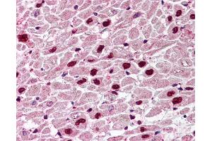 Anti-UNG antibody IHC of human heart. (UNG anticorps  (C-Term))