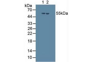 Figure. (CYP17A1 anticorps  (AA 183-508))