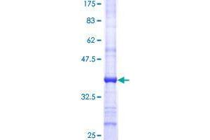 Image no. 1 for SWI/SNF Related, Matrix Associated, Actin Dependent Regulator of Chromatin, Subfamily A-Like 1 (SMARCAL1) (AA 491-599) protein (GST tag) (ABIN1320630)