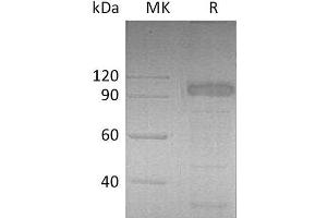 Western Blotting (WB) image for Interleukin 23 Receptor (IL23R) protein (Fc Tag) (ABIN7320558) (IL23R Protein (Fc Tag))