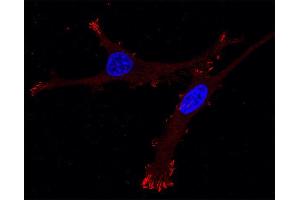 Immunocytochemistry (ICC) image for anti-Zyxin (ZYX) (AA 352-357) antibody (ABIN1742558) (ZYX anticorps  (AA 352-357))