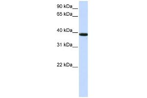 WB Suggested Anti-KLHDC8B Antibody Titration:  0. (KLHDC8B anticorps  (Middle Region))