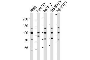 Western blot analysis of lysates from Hela, HepG2, MCF-7, SH-SY5Y, mouse NIH/3T3 cell line (from left to right), using FGFR1 Antibody (Center) (ABIN6243223 and ABIN6577702).