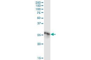 Immunoprecipitation of C1QA transfected lysate using anti-C1QA MaxPab rabbit polyclonal antibody and Protein A Magnetic Bead , and immunoblotted with .