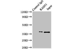 Immunoprecipitating RAD51 in K562 whole cell lysate Lane 1: Rabbit control IgG (1 μg) instead of ABIN7150287 in K562 whole cell lysate. (RAD51 anticorps  (AA 1-228))