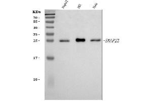 Western blot analysis of SNAP23 using anti-SNAP23 antibody (ABIN7599089). (SNAP23 anticorps  (AA 1-211))