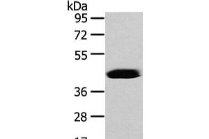 Western Blot analysis of Hela cell using VASH2 Polyclonal Antibody at dilution of 1/450 (Vasohibin 2 anticorps)