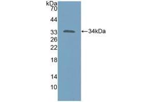 Detection of Recombinant KATNA1, Human using Polyclonal Antibody to Katanin P60 Subunit A 1 (KATNA1) (KATNA1 anticorps  (AA 8-229))