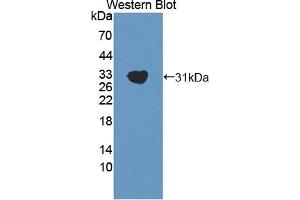 Detection of Recombinant GAB2, Mouse using Polyclonal Antibody to GRB2 Associated Binding Protein 2 (GAB2) (GAB2 anticorps  (AA 357-607))