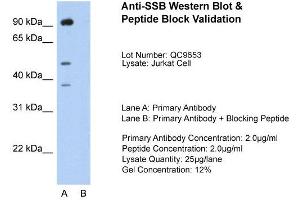 Host:  Rabbit  Target Name:  SSB  Sample Type:  Jurkat  Lane A:  Primary Antibody  Lane B:  Primary Antibody + Blocking Peptide  Primary Antibody Concentration:  2. (SSB anticorps  (N-Term))
