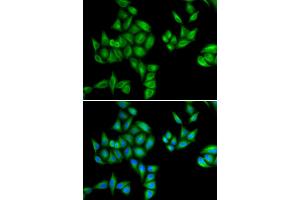 Immunofluorescence analysis of HeLa cells using BTG1 antibody (ABIN5973768). (BTG1 anticorps)
